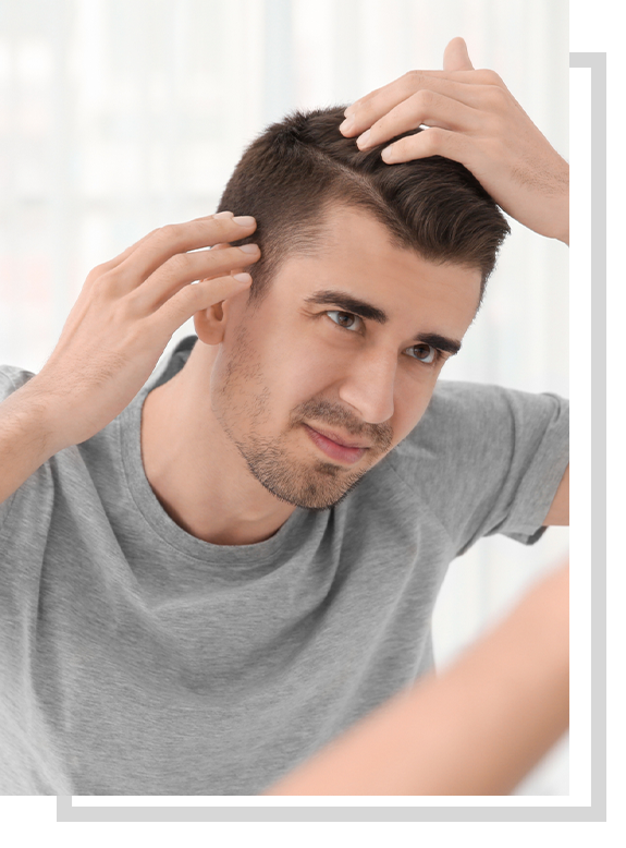 man inspecting hair loss