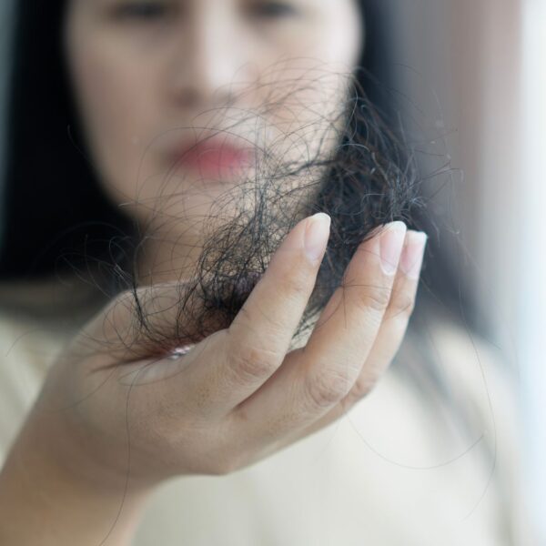 woman holding hair that fell out