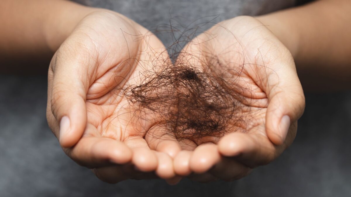 Woman holding hair that fell out