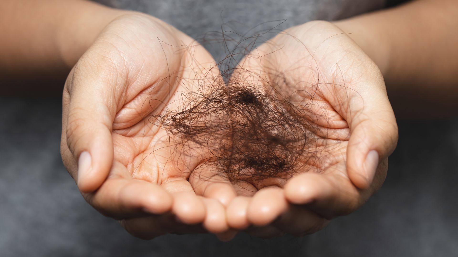 Woman holding hair that fell out