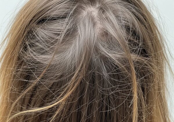 A woman's hair full of knots.